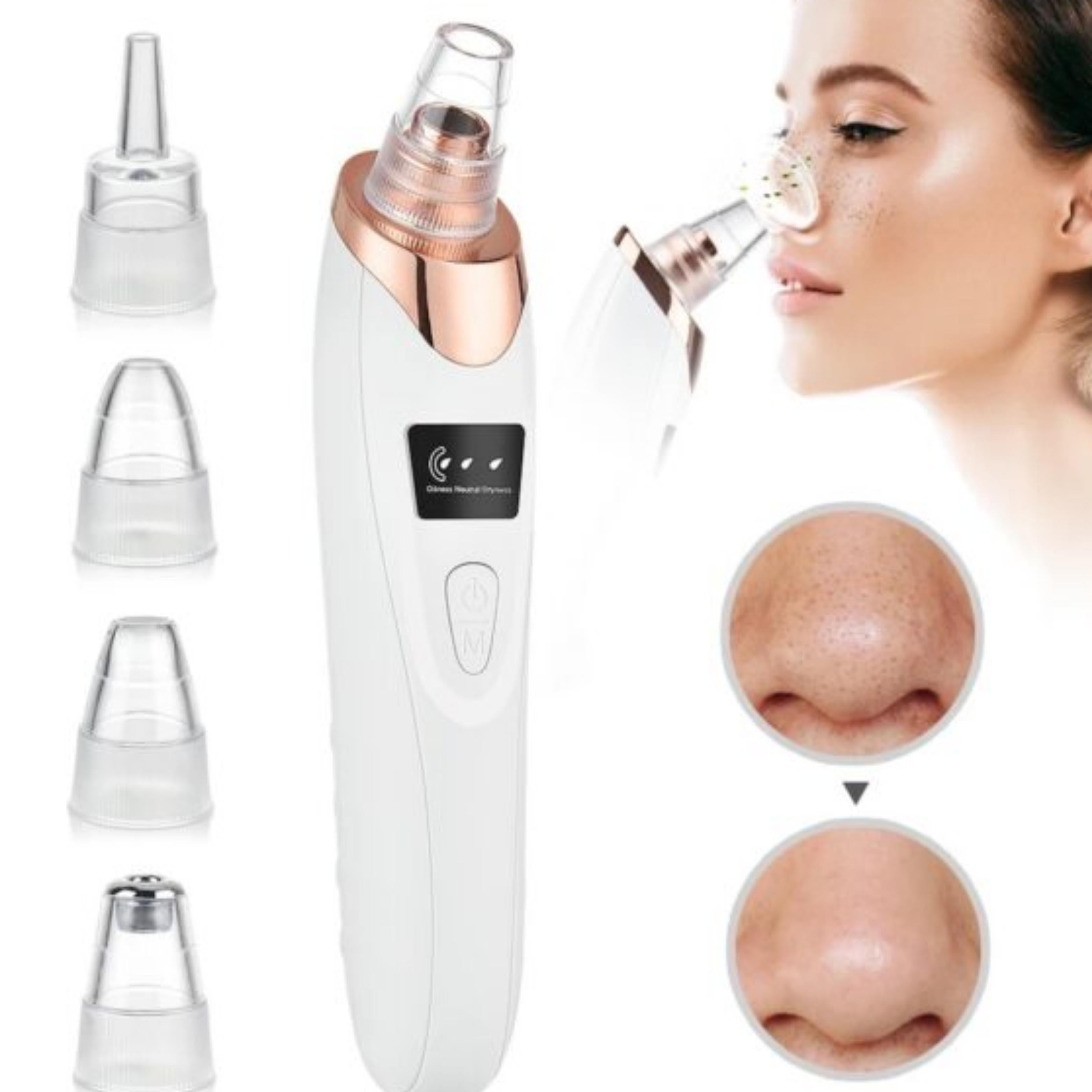 Facial Blackhead Remover Pore Cleaner Vacuum Peeling Dead Skin - aero revive 2